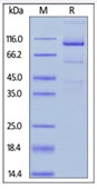SDS-PAGE (GPC3-338H).jpg